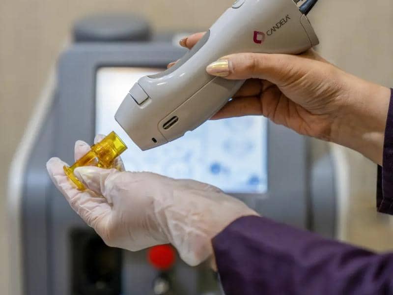 لیزر موهای زائد بی&zwnj;خطر است؟ بررسی تخصصی عوارض و راه&zwnj;های پیشگیری در مشهد