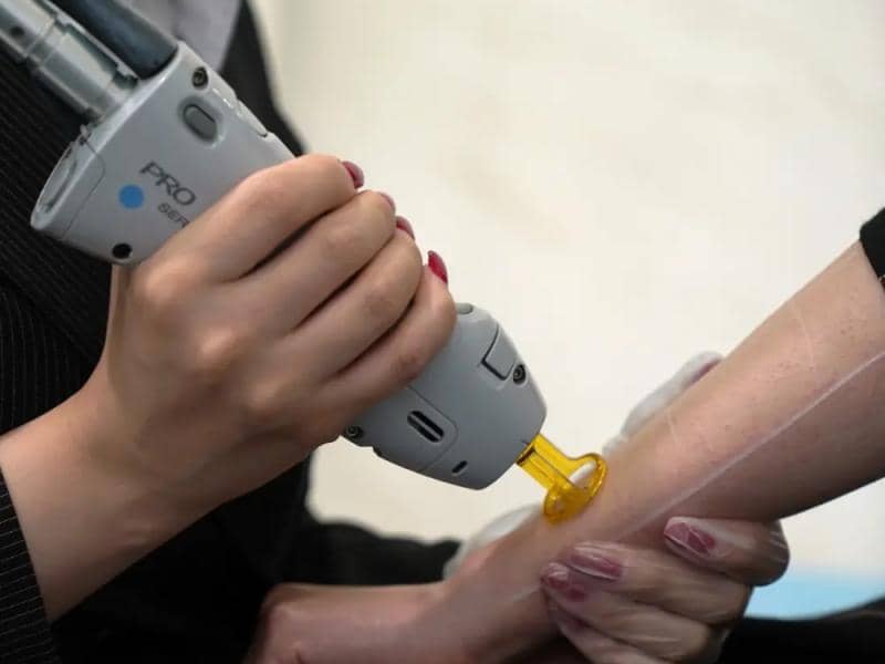 لیزر موهای زائد بی&zwnj;خطر است؟ بررسی تخصصی عوارض و راه&zwnj;های پیشگیری در مشهد