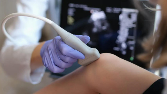 Prf و اهمیت آن در دستگاه سونوگرافی